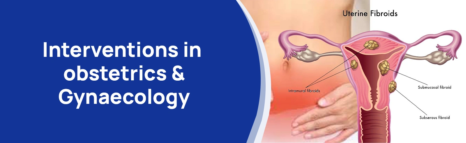 Interventions in obstetrics and Gynaecology 01